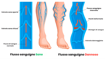 Calze a compressione