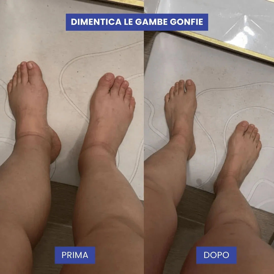 Calze a compressione