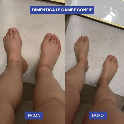 Calze a compressione